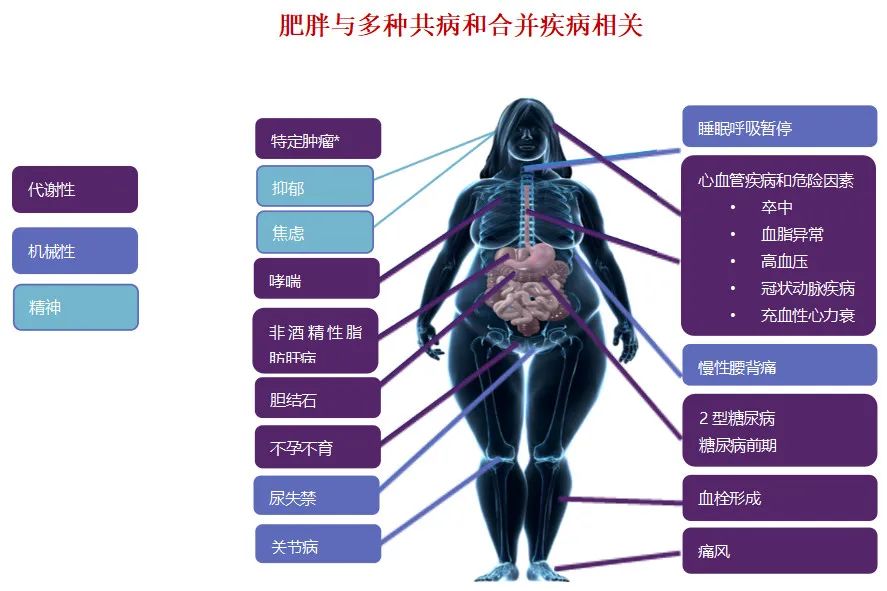 尊龙凯时集团总医院成立“减重中心”——内分泌科、胃肠外科、营养科联合让您“如释重负”